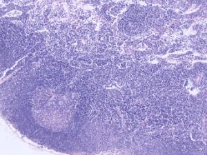 Lymph Node, Primate Slide