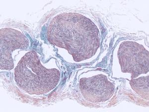 Nervous Tissue Slide