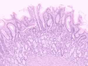 Stomach, Pyloric Region, Primate Slide