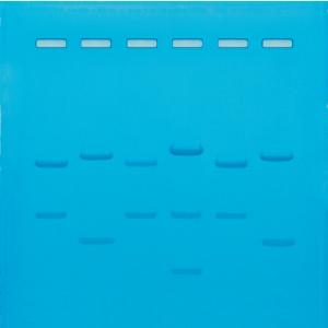 DNA Fingerprinting by Restriction Enzyme Patterns