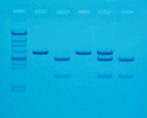 Cholesterol Diagnostic Lab Activity