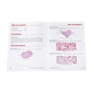 Endocrine System Slide Set