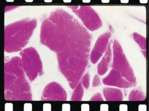 Muscle (Mammalian), Striated Slide