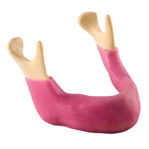 Premium Edentulous Mandible Wgum