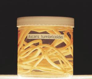 Ascaris Lumbricoides