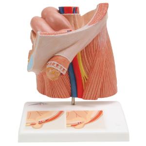 Inguinal Hernia Model