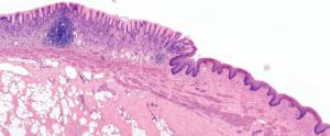 Esophagus-Stomach Junction, Mammal Slide