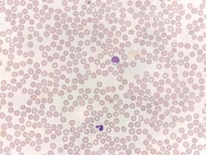 Peripheral Blood, Human Male Slide