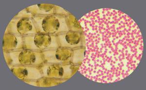 Ward's® Why Cells Shrink and Swell Lab Activity