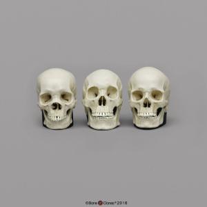 BoneClones® 1:2 Scale Regional Human Skull Sets