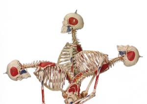 Rudiger® Flexible Ligamentary Skeleton