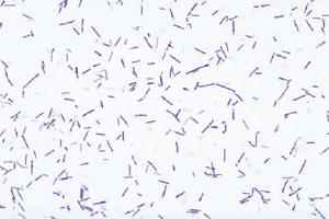 <i>Clostridium botulinum</i>