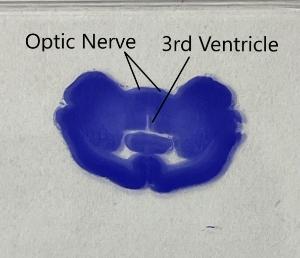 Hypothalamus slide