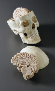 BoneClones® Skull with Brain