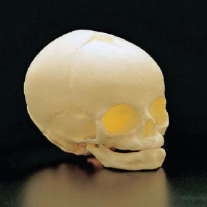 3B Scientific® Fetal Skull