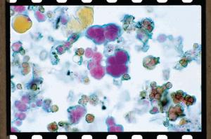 Protococcus, Pleurococcus, Whole Mount Slides