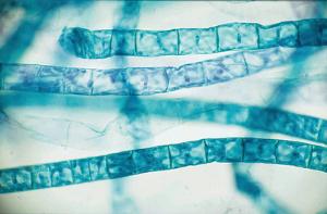 Spirogyra, Vegetative Slide