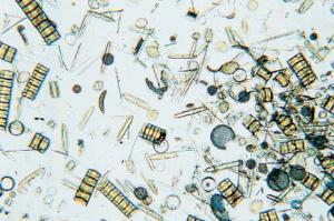 Diatom Strew Slide