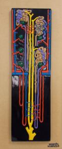 Ward's® Kidney Nephron Model