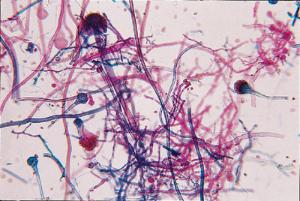 Mucor, Sporangia and Zygotes Slide