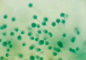 <i>Aspergillus</i>, Conidiophores