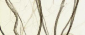 Medullated Nerve Fibers, Teased Preparation Slide