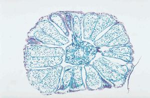 Ward's® Pine Structure Microscope Slides