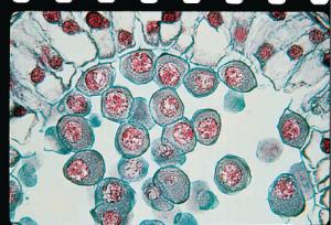 Lily Meiosis, Early Prophase Slide