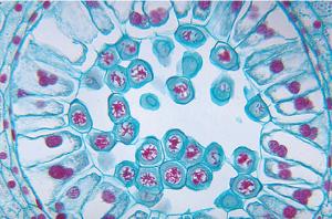 Lily Meiosis, Late Prophase Slide