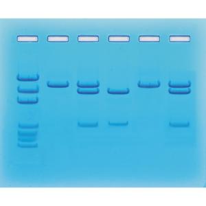 Nucleic acid detection for COVID-19