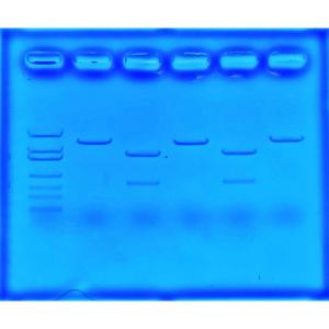 Gene detection for cystic fibrosis