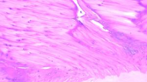 White fibro-cartilage, intervertebral disc slide