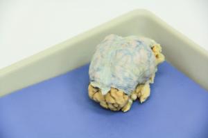 Pig Brain