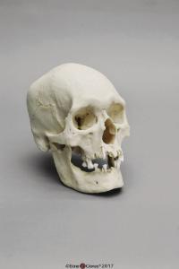 Human Male Polynesian Skull