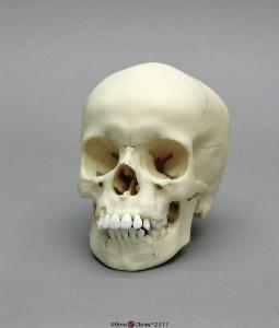 Human Child Skull 9-year-old