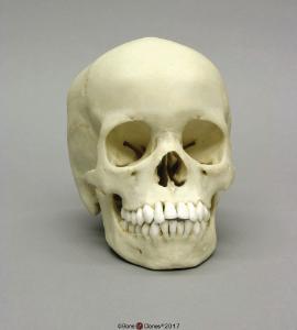 Human Child Skull 13-year-old