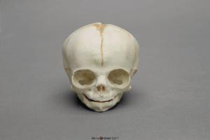 Human Fetal Skull 30 Weeks