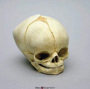 Human Fetal Skull 40 1/2 Weeks (Full Term)