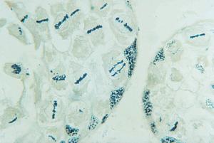 Crayfish Mitosis/Meiosis