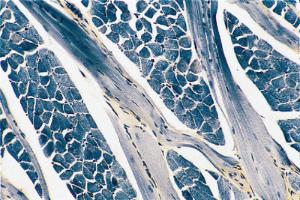 Skeletal Muscle, Striations Slide