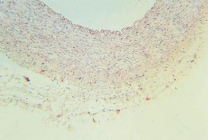 Artery, cross section, Hematoxylin & Eosin Stained Slides