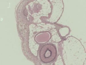 Artery, Vein and Nerve Slide