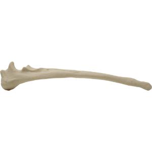 Ulna right