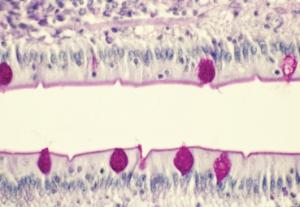 Small Intestine, Goblet Cells Slide