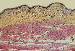 Urinary Bladder, Distended Slide