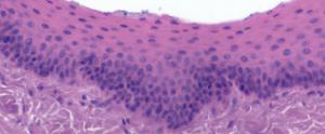 Stratified Squamous Epithelium Slide