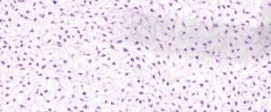 Mesenchyme Slide