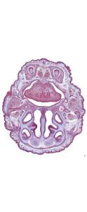 Osteogenesis, Intramembranous Ossification Slide