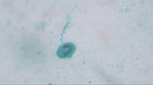 Vorticella Slide