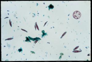 Protist Motility Slide